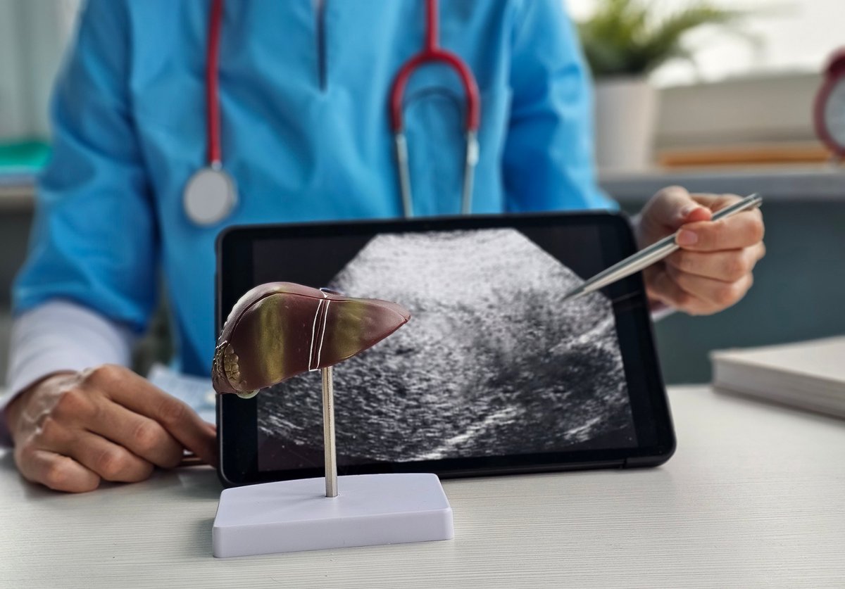 Doctor examinando modelo de hígado y resultados de ultrasonido